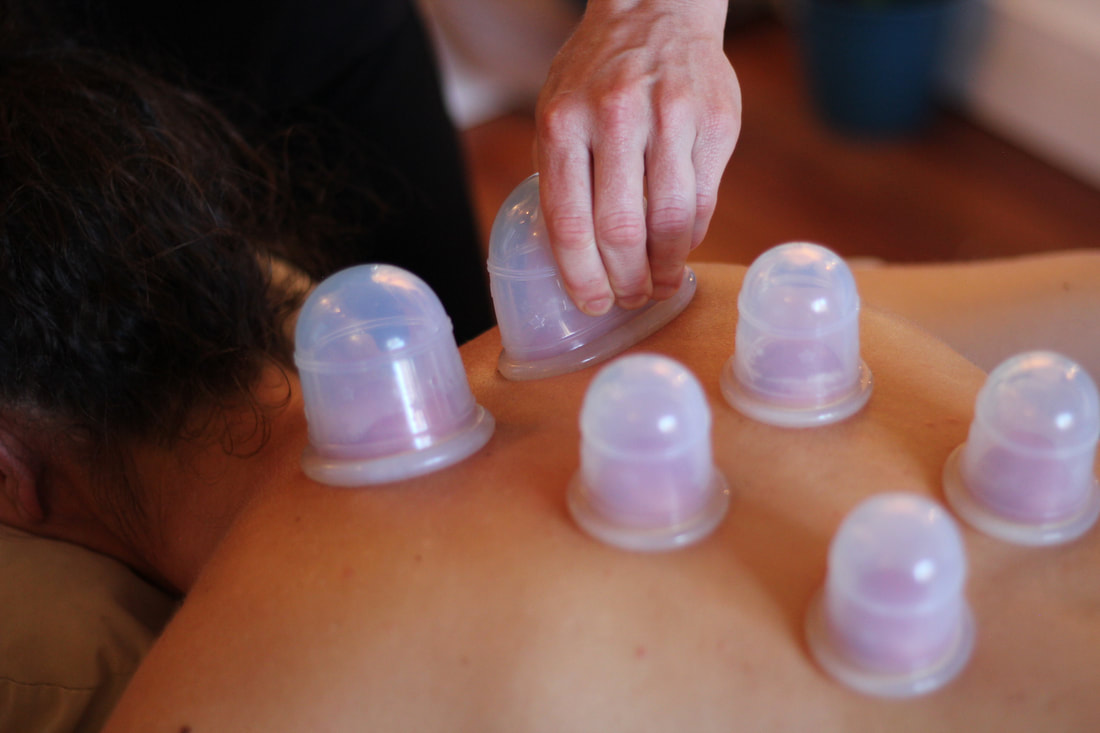 Experience the ultimate relaxation and healing with our integrative massage therapy in Asheville, NC. Our skilled therapists also offer cupping therapy for added benefits. Book your session now!